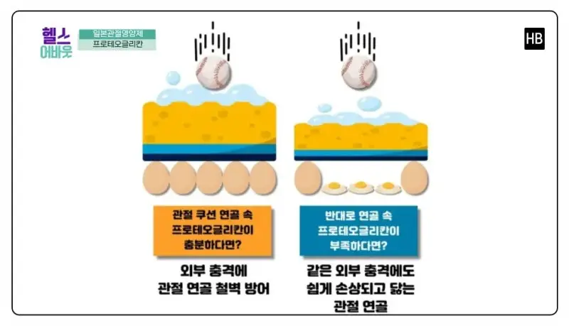 일본관절약 영양제