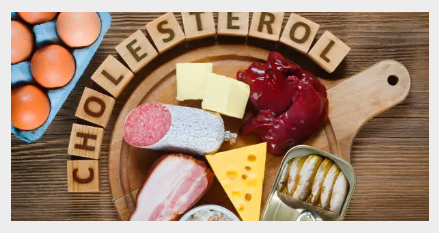 고지혈증 높이는 음식