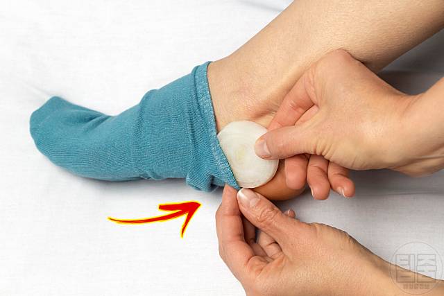 발바닥 양파 양말속에 양파 넣고자면