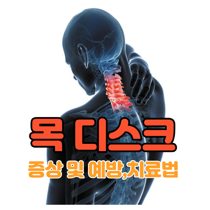 목디스크