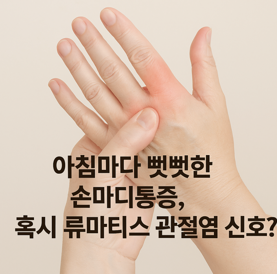 아침마다 뻣뻣한 손마디통증, 혹시 류마티스 관절염 신호?