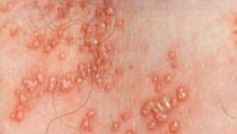 출처:삼성서울병원 건강칼럼