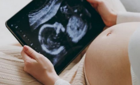 임신 초기증상10