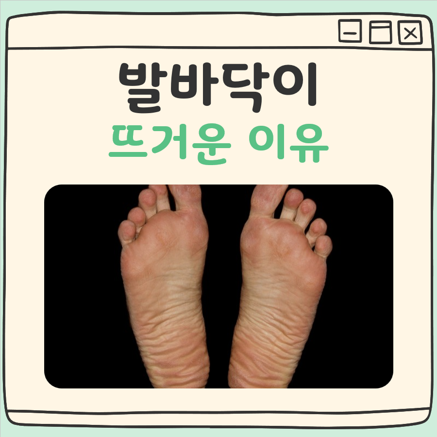 발바닥이 뜨거운 이유 대표 이미지