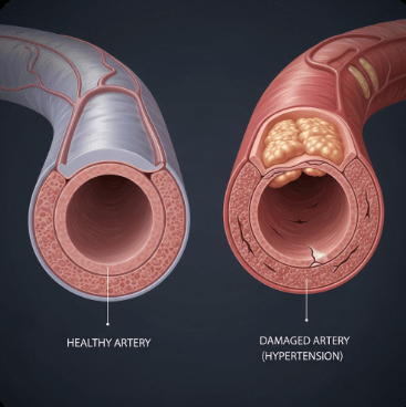 고혈압 약 부작용과 관리법2