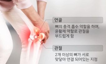 관절 연골 보호, 염증 억제, 근육 강화, 체중 관리 실천법