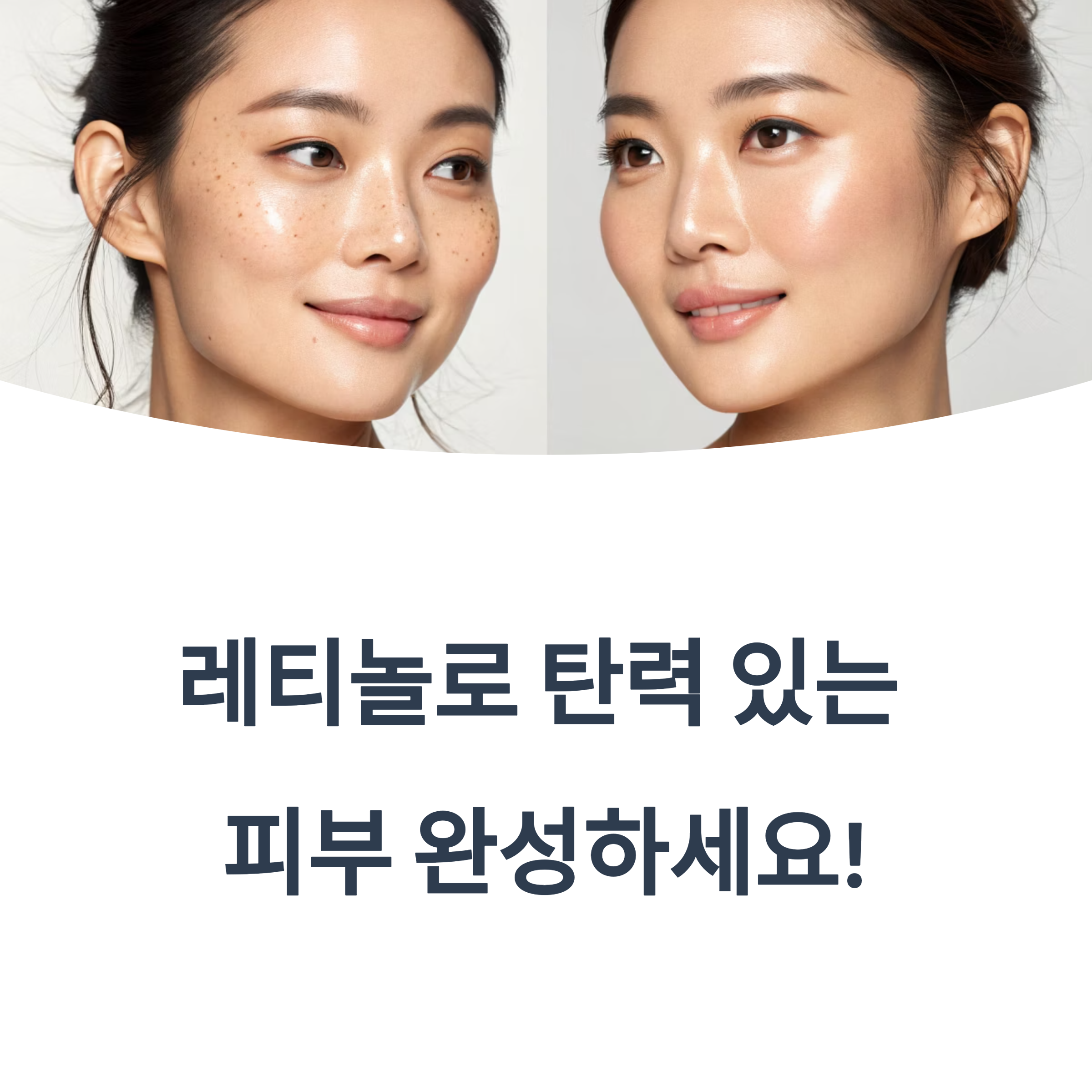 레티놀로 탄력 있는 피부 완성! 주름 개선과 재생