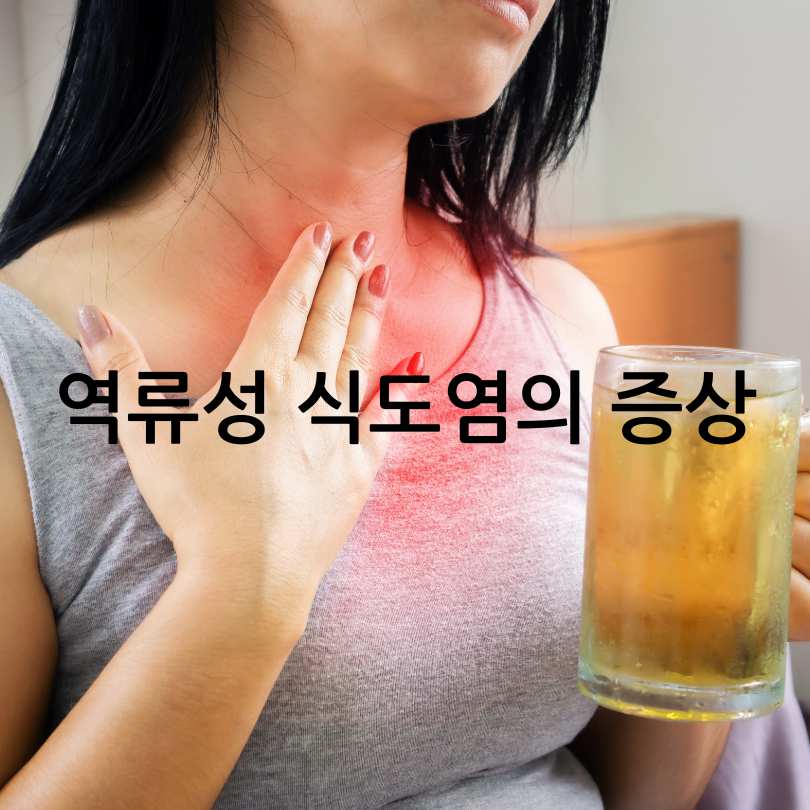 역류성 식도염 증상 총정리