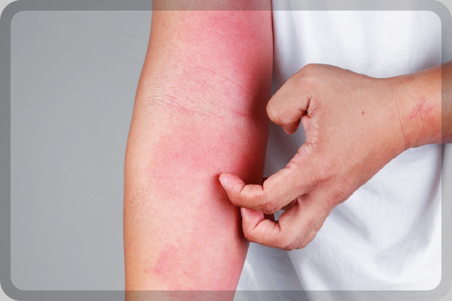 아르기닌-부작용