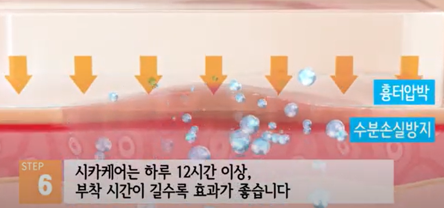 시카케어 겔시트 약국에서 사서, 제왕절개 배 흉터 관리했어요.