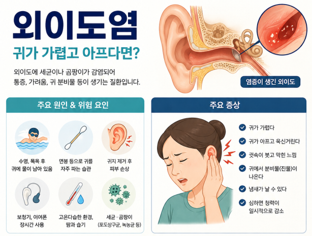외이도염