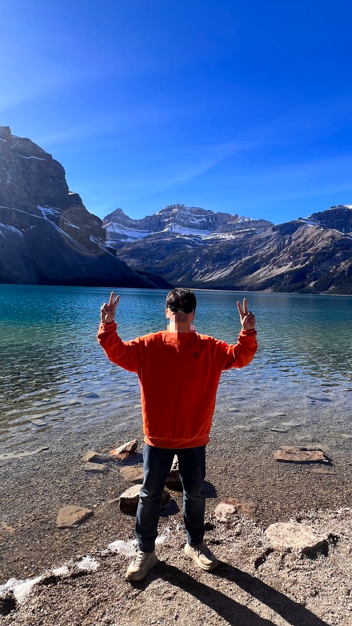 보우레이크 뷰포인트에서 나도 한 컷. 서양 음식이 너무 짜서 그런가, 자고 나면 뿔어있다.
