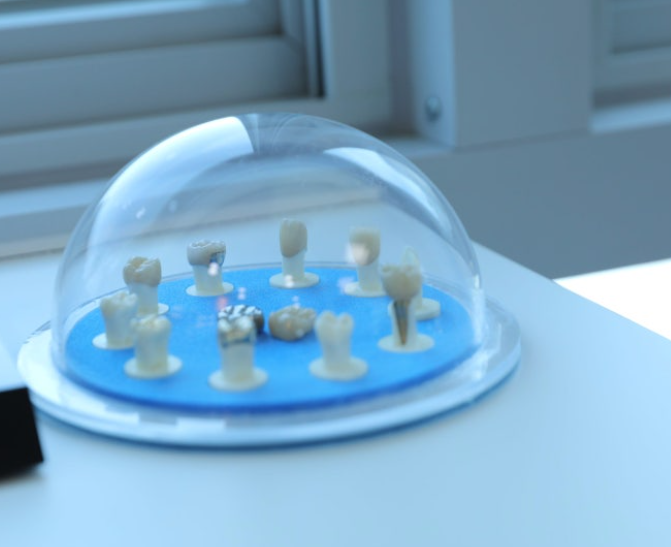 크라운치료-사진6