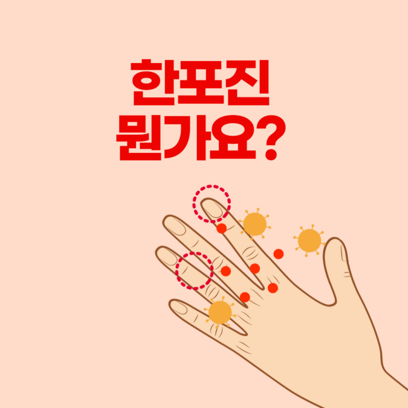 한포진원인