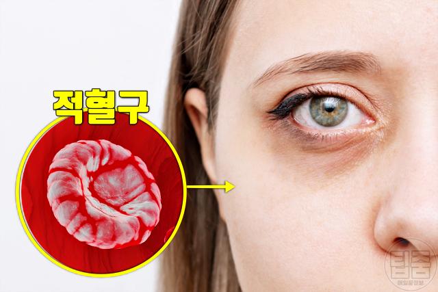 철분 결핍 증상 창백한 얼굴
