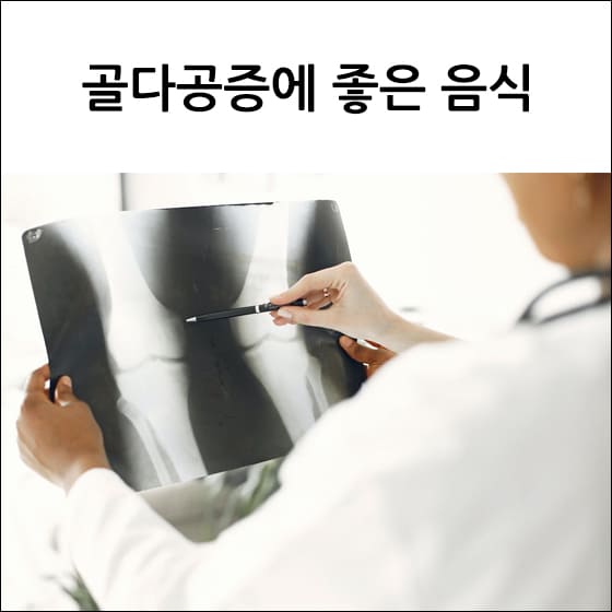 엑스레이를 보고 있는 의사