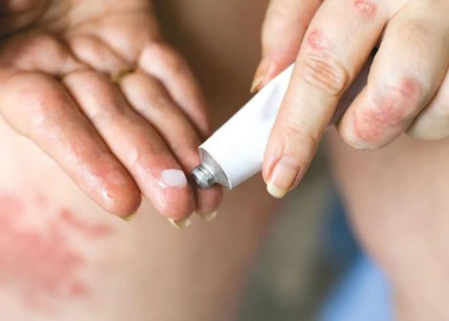 자반증 초기증상