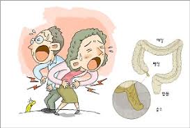 맹장염 증상과 원인