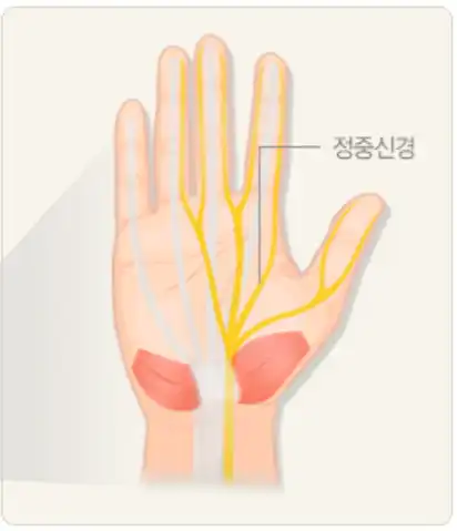 정중신경-그림-이미지