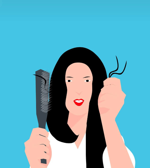 청년탈모지원금