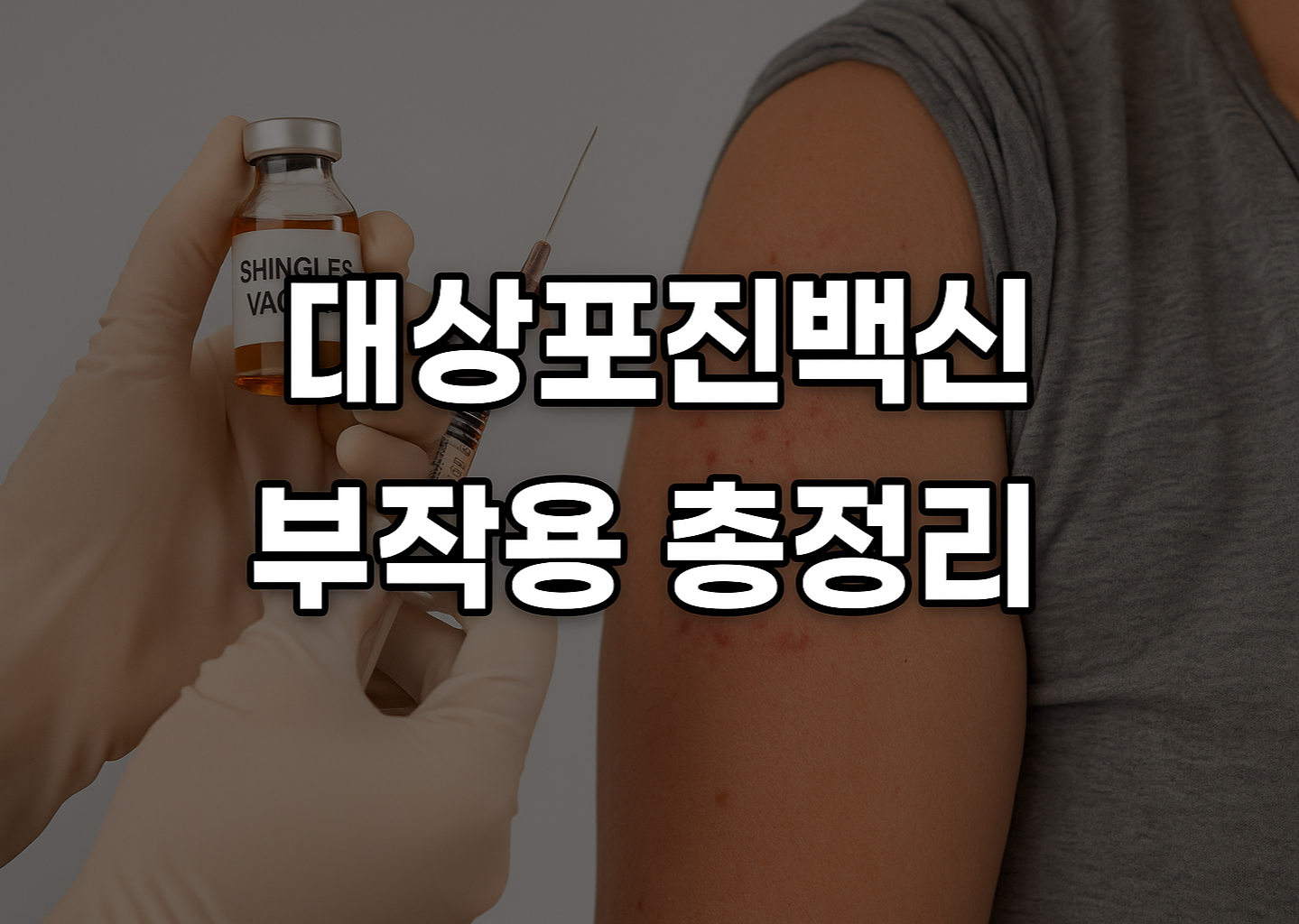 대상포진백신 부작용 총정리 이미지