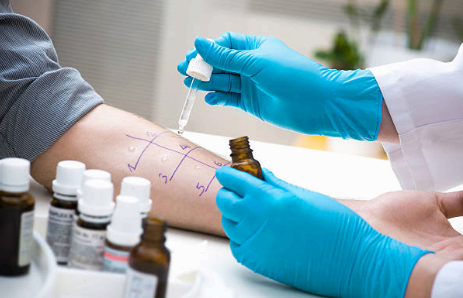 피부 반응 검사 이미지사진