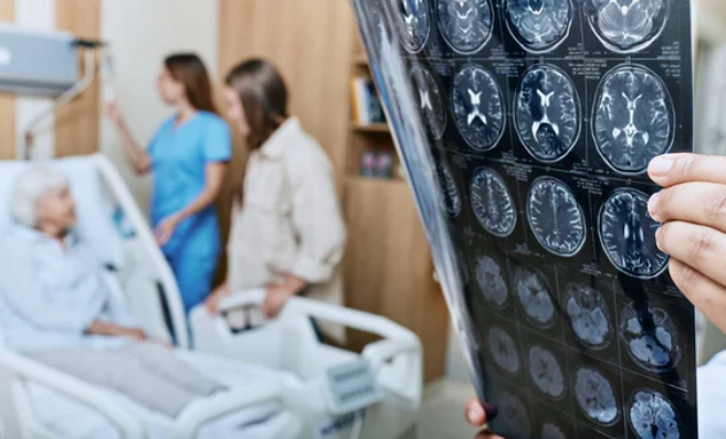 뇌졸중 환자 생존율과 재발률 연구 결과