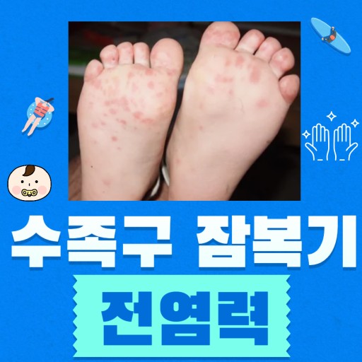 수족구병: 원인, 증상, 예방 및 관리 방법 총정리