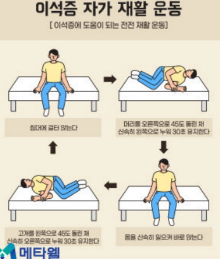 이석증-자가재활운동