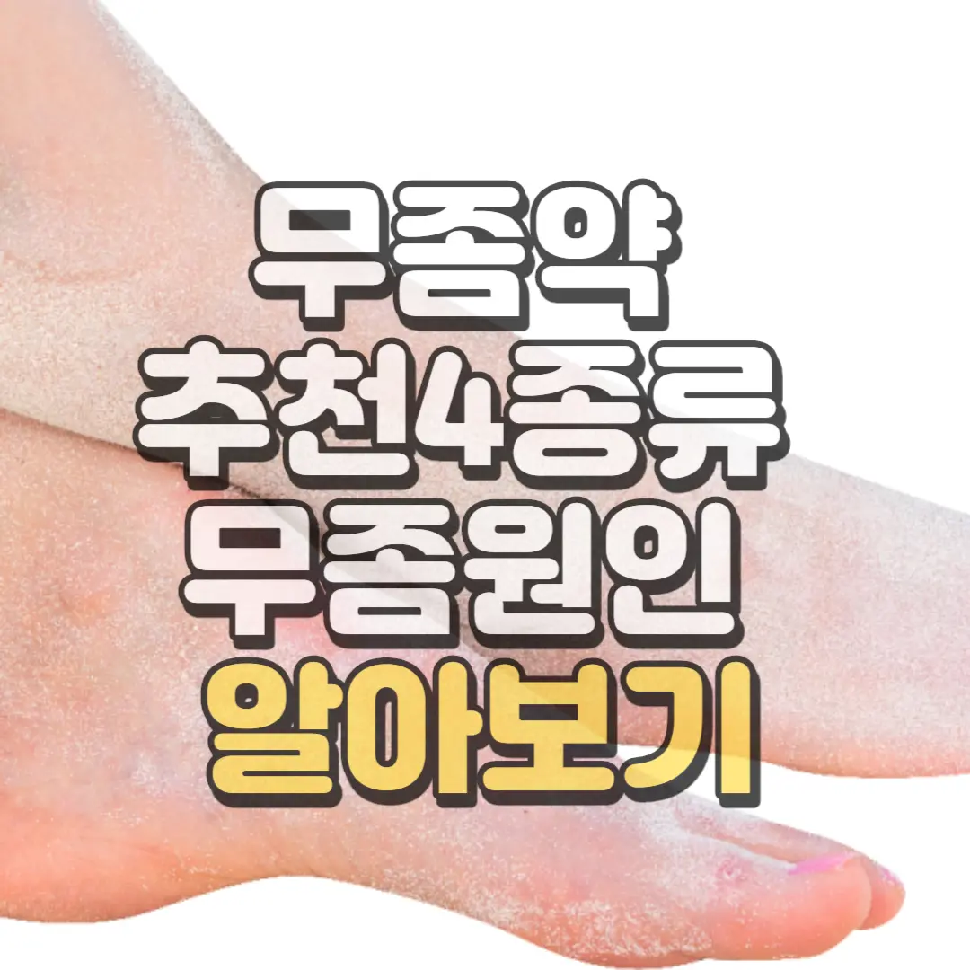 무좀약 추천4종류 추가 정보