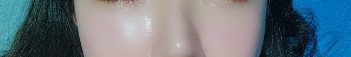 시술 후 내얼굴 화장함