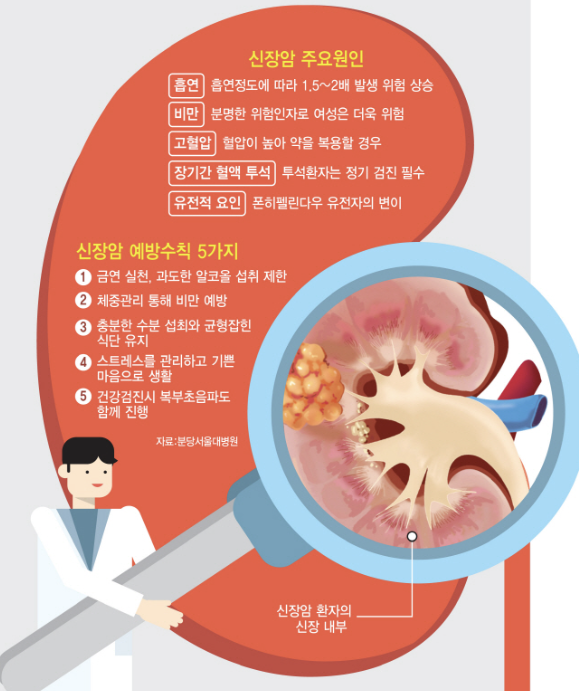 신장암 초기증상 1
