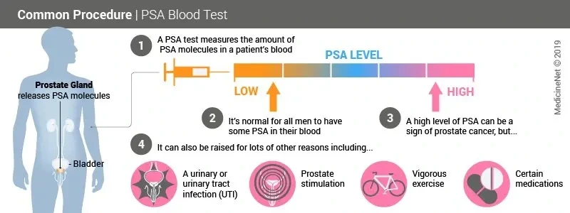 PSA 정상수치