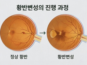 루테인 복용시간