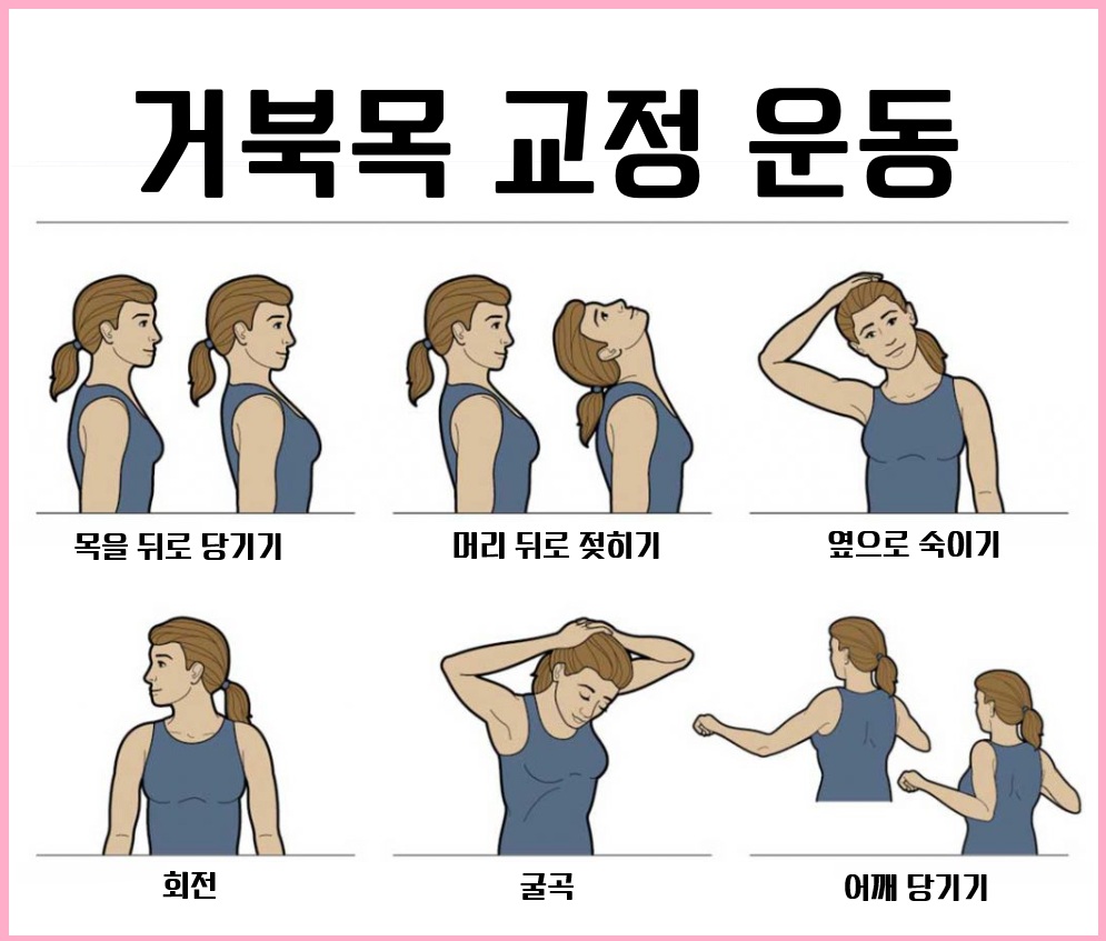 거북목 교정 완벽 가이드: 효과적인 운동법과 팁