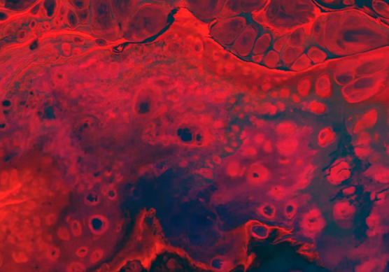 히알루론산 효능