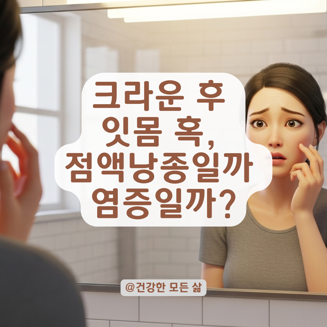 크라운 치료 후 잇몸에 혹이?? 단순 점액낭종인지 구분하는 법!
