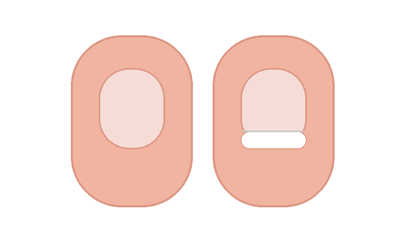 손톱 들림(조갑박리) 완전 정리: 손톱이 하얗게 뜨는 이유와 원인별 감별 포인트