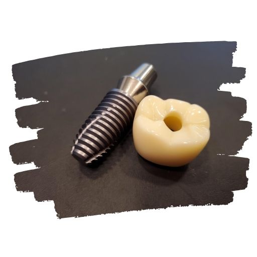 평택 임플란트 잘하는 곳