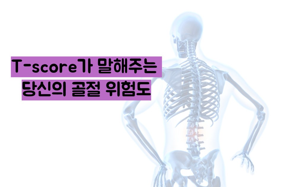 골다공증 수치