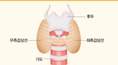 갑상선 이미지
