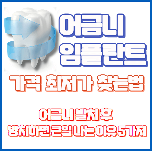 임플란트-가격-어금니-가격-비교-시술-후기