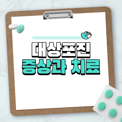 대상포진