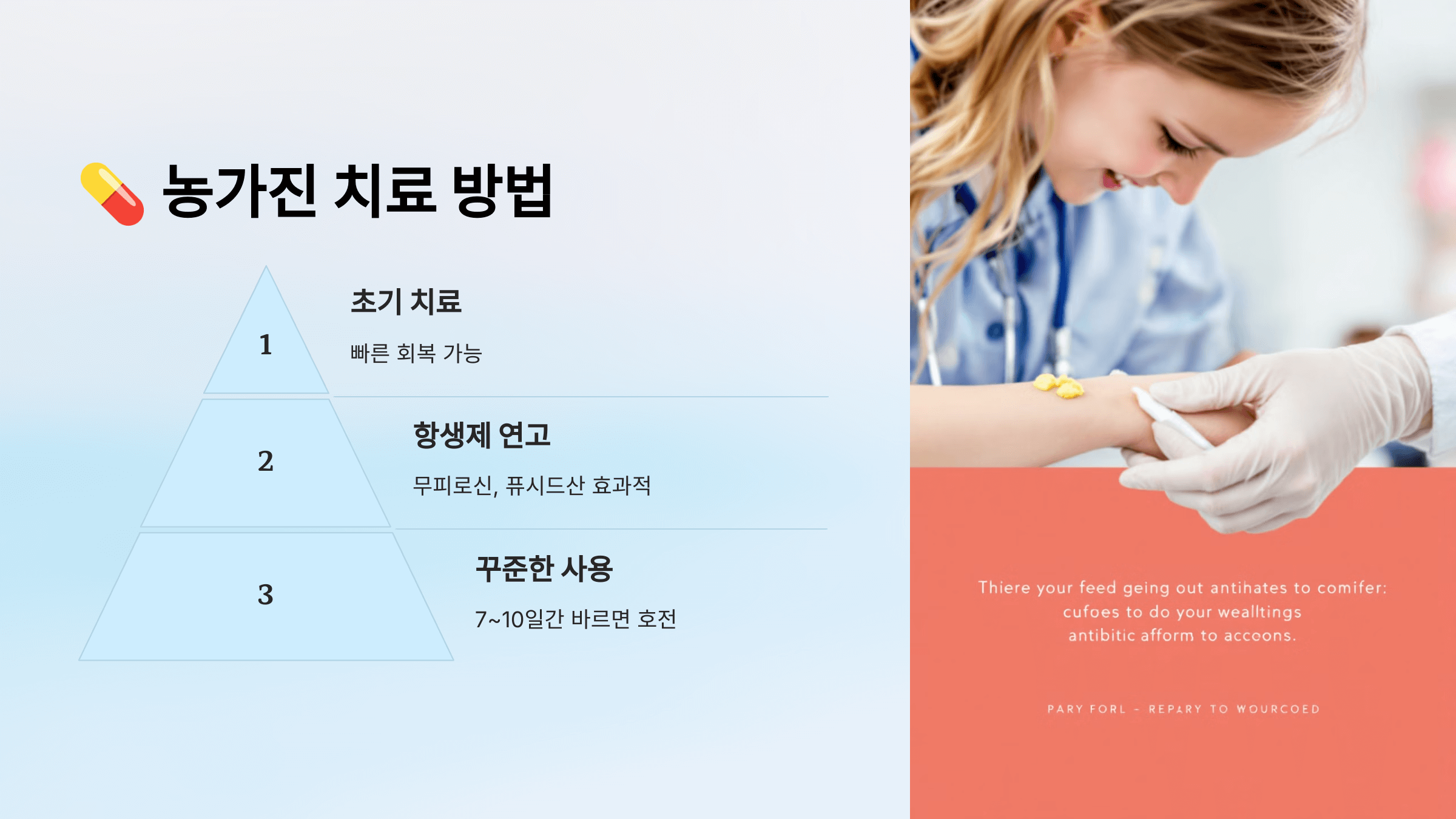 농가진과 관련된 사진입니다.