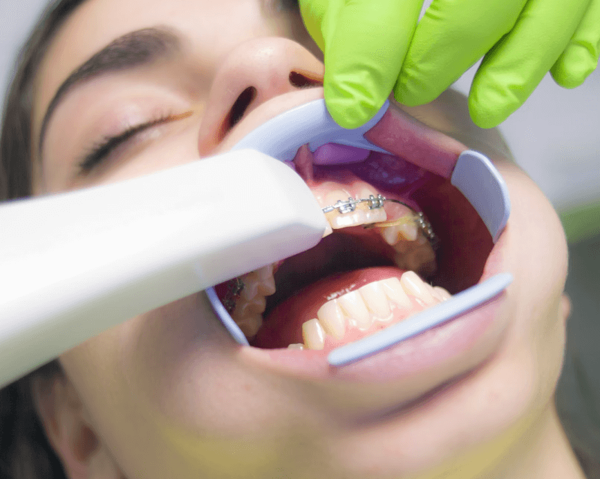 이빨 빠지는 시기