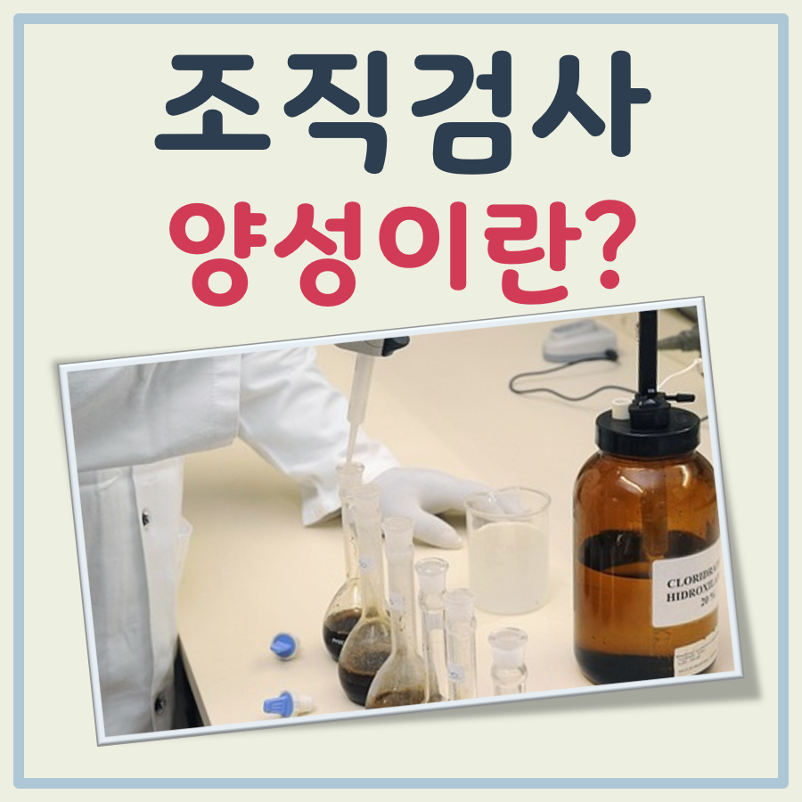 조직검사 양성이란