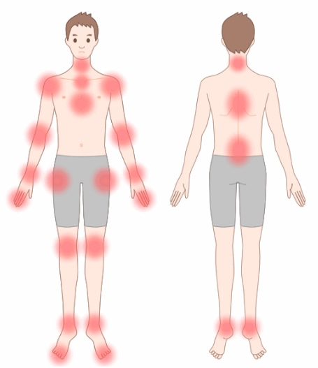 근육통 자주 발생하는 몸 부위