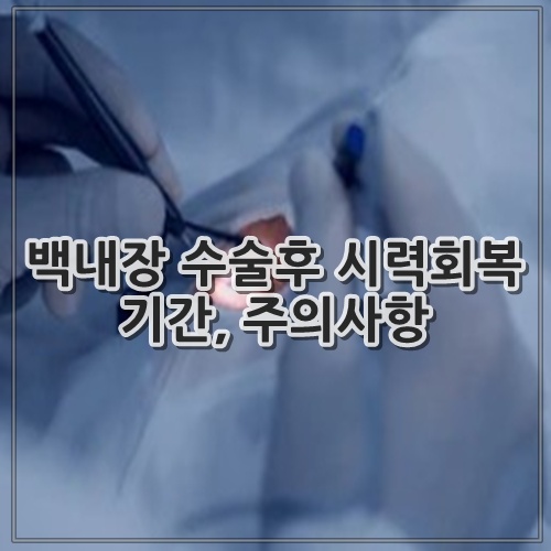 백내장 수술후 시력회복 기간, 주의사항