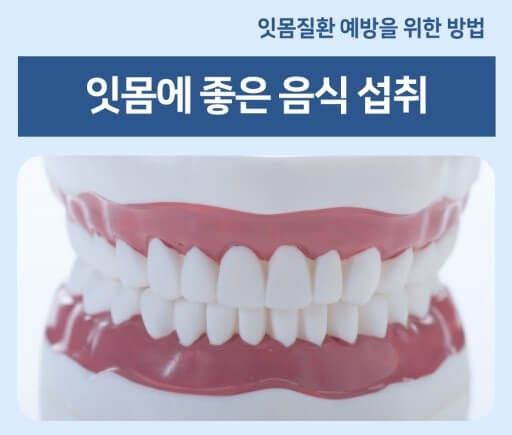 건강한 잇몸