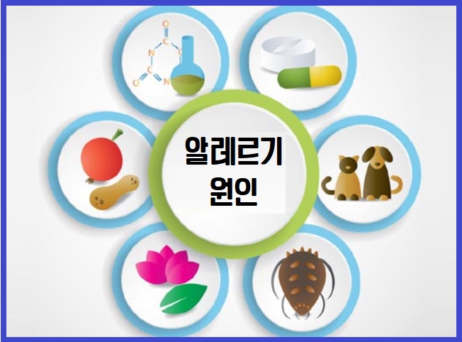 알레르기 원인